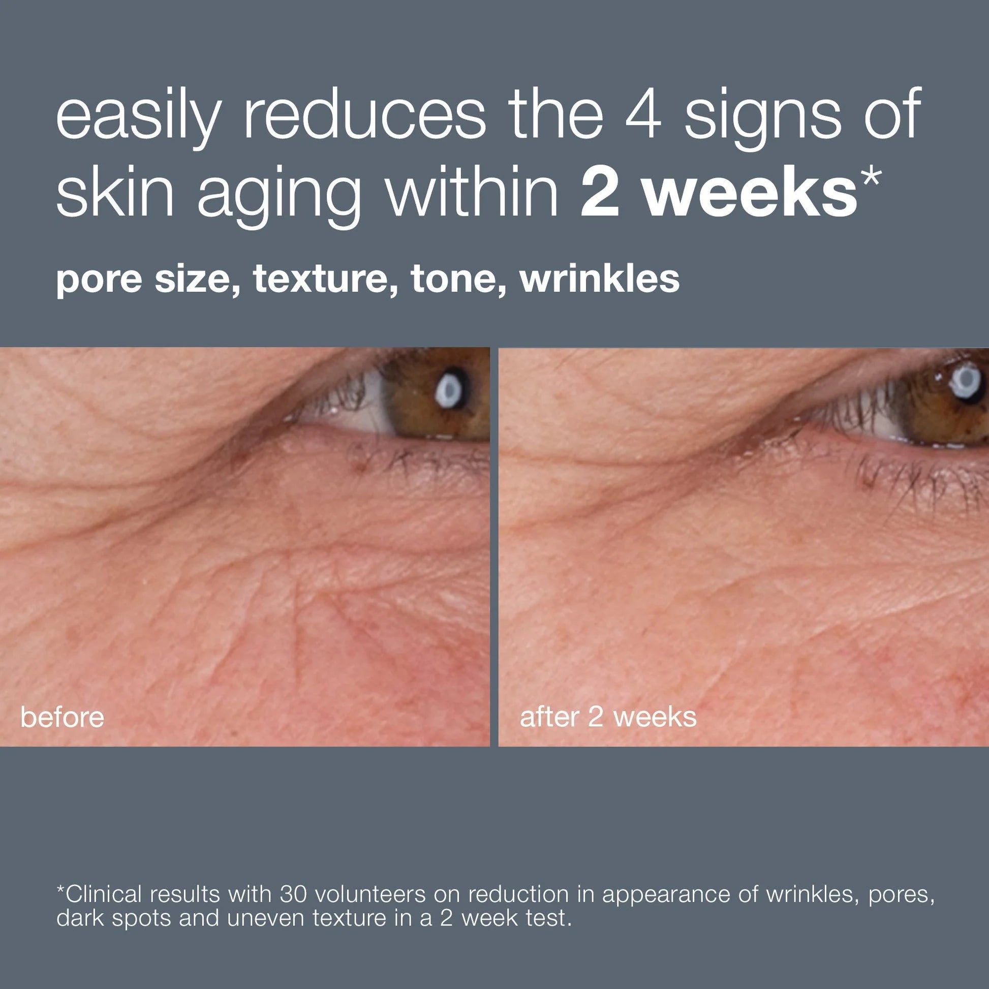 Dermalogica® Dynamic Skin Retinol Serum