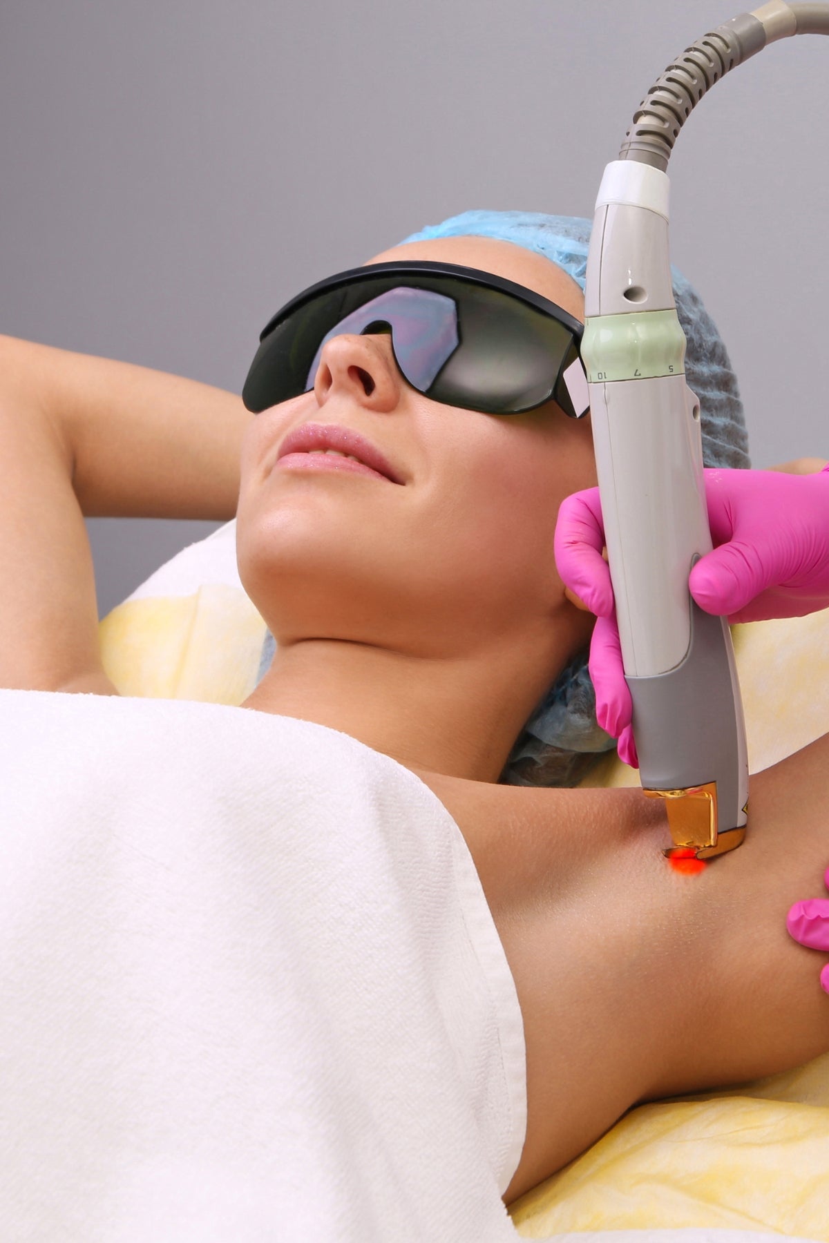 Laser Hair Removal